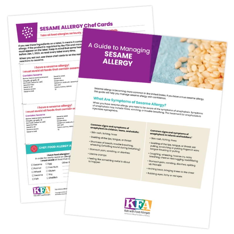 Managing Sesame Allergy/Chef Cards (PDF)